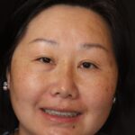 Full Mouth Rehabs 40 thumbnail