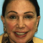 Bridge Case 3 thumbnail