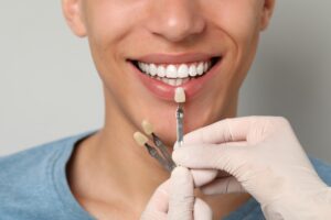 dentist checking a male patients tooth color for veneers